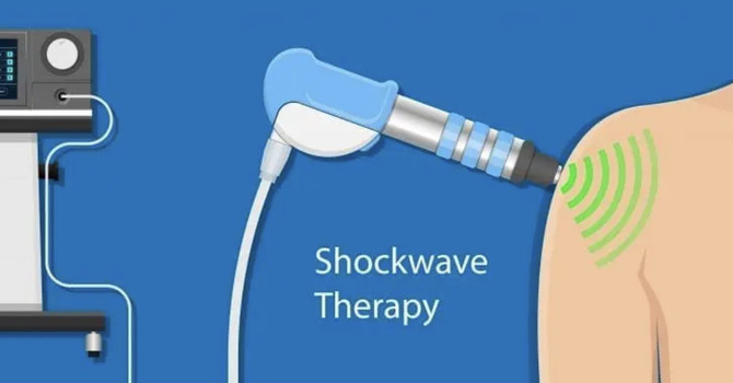 What is shockwave therapy? What is it used for? 